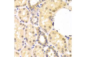 Immunohistochemistry of paraffin-embedded human kidney using SMAD1 antibody. (SMAD1 Antikörper)