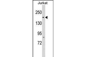 RPAP1 Antikörper  (N-Term)