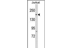 RP1 Antibody (N-term) (ABIN1539273 and ABIN2848774) western blot analysis in Jurkat cell line lysates (35 μg/lane).