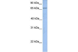 WB Suggested Anti-ACSL1 Antibody Titration:  0.