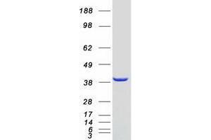Western Blotting (WB) image for Vacuolar Protein Sorting-Associated Protein 26A (VPS26A) (Transcript Variant 1) protein (Myc-DYKDDDDK Tag) (ABIN2735418)