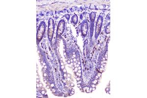 IHC analysis of RASAL1 using anti-RASAL1 antibody (ABIN6719367). (RASAL1 Antikörper  (AA 721-798))