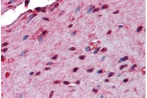 Human Small Intestine, Muscularis Propria: Formalin-Fixed, Paraffin-Embedded (FFPE) (STIP1 Antikörper  (AA 1-544))