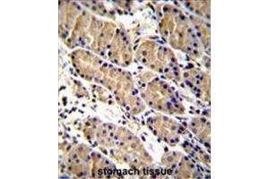 Immunohistochemistry (Paraffin-embedded Sections) (IHC (p)) image for anti-WAP Four-Disulfide Core Domain 1 (WFDC1) (AA 147-177), (C-Term), (His163) antibody (ABIN955571)