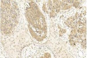 Immunohistochemistry (IHC) image for anti-Microphthalmia-Associated Transcription Factor (MITF) (AA 1-28), (N-Term) antibody (ABIN655506)