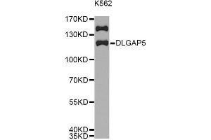 Western blot analysis of extracts of K562 cells, using DLGAP5 antibody (ABIN5971223) at 1/1000 dilution. (DLGAP5 Antikörper)