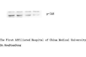 Western Blot (WB) analysis: Please contact us for more details. (NFKBIA Antikörper  (pSer32, pSer36))