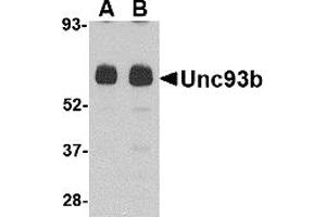 Western Blotting (WB) image for anti-Unc-93 Homolog B1 (UNC93B1) (N-Term) antibody (ABIN1031653) (UNC93B1 Antikörper  (N-Term))