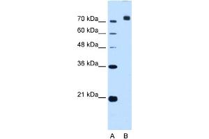 WB Suggested Anti-CORIN Antibody Titration:  2. (Corin Antikörper  (C-Term))