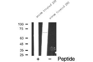 Western blot analysis of FKHR expression in serum treated 293 whole cell lysates,The lane on the left is treated with the antigen-specific peptide. (FOXO1 Antikörper  (Internal Region))