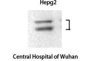 Western Blotting (WB) image for anti-Mitogen-Activated Protein Kinase 1/3 (MAPK1/3) (C-Term) antibody (ABIN3184545)