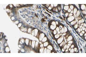 ABIN6272259 at 1/100 staining Rat colon tissue by IHC-P. (BTBD6 Antikörper  (Internal Region))