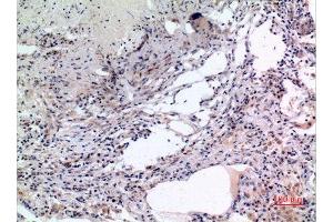 Immunohistochemistry (IHC) analysis of paraffin-embedded Human Lung, antibody was diluted at 1:100. (MCM7 Antikörper  (Internal Region))