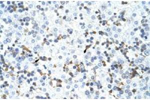 Immunohistochemical staining (Formalin-fixed paraffin-embedded sections) of human liver with CPSF3 polyclonal antibody  at 4-8 ug/mL working concentration. (CPSF3 Antikörper  (C-Term))