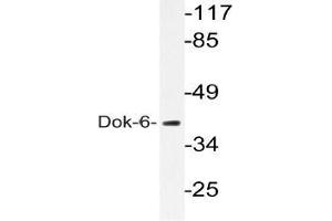 Western blot (WB) analysis of Dok-6 pAb in extracts from COLO205 cells. (DOK6 Antikörper)