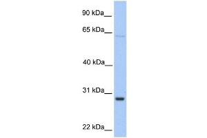 WB Suggested Anti-HPRT1 Antibody Titration:  0. (HPRT1 Antikörper  (Middle Region))