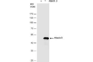 WB Image Ataxin 3 antibody detects Ataxin 3 protein by western blot analysis. (Ataxin 3 Antikörper)
