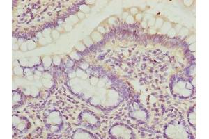 Immunohistochemistry of paraffin-embedded human small intestine tissue using ABIN7150894 at dilution of 1:100