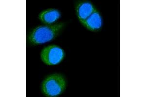 IF analysis of CD14 using anti-CD14 antibody (ABIN7600531). (CD14 Antikörper  (AA 20-259))