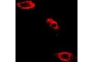 Immunofluorescent analysis of SHMT2 staining in HepG2 cells. (SHMT2 Antikörper)