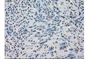 Immunohistochemical staining of paraffin-embedded Ovary tissue using anti-BUB1Bmouse monoclonal antibody. (BUB1B Antikörper)