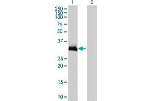 Western Blot analysis of HOXC9 expression in transfected 293T cell line by HOXC9 monoclonal antibody (M01), clone 2B12. (HOXC9 Antikörper  (AA 1-260))