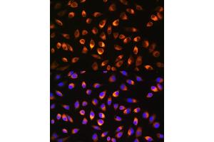 Immunofluorescence analysis of L929 cells using NQO1 Rabbit pAb (ABIN3022059, ABIN3022060, ABIN3022061 and ABIN6218589) at dilution of 1:100. (NQO1 Antikörper  (AA 1-50))