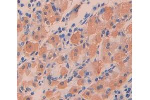 Used in DAB staining on fromalin fixed paraffin- embedded stomach tissue (PTPN9 Antikörper  (AA 289-593))