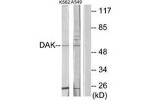 Western Blotting (WB) image for anti-TKFC / DAK (AA 91-140) antibody (ABIN2889629) (TKFC / DAK (AA 91-140) Antikörper)