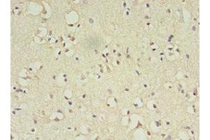 Immunohistochemistry of paraffin-embedded human brain tissue using ABIN7144817 at dilution of 1:100 (ATL3 Antikörper  (AA 1-187))