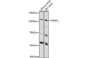 Western blot analysis of extracts of various cell lines, using P antibody  at 1:1000 dilution. (PARP1 Antikörper)