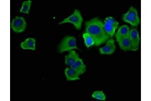 Immunofluorescence staining of MCF-7 cells with ABIN7168912 at 1:133, counter-stained with DAPI. (Hepsin Antikörper  (AA 294-413))