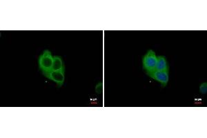 ICC/IF Image NOX1 antibody detects NOX1 protein at cytoplasm by immunofluorescent analysis. (NOX1 Antikörper)