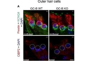 No change in inner hair cell (IHC) or outer hair cell (OHC) phenotype or reduction in numbers of afferent synaptic contacts with OHCs or IHCs was observed in GC-B KO mice. (KCNQ4 Antikörper  (AA 2-77))