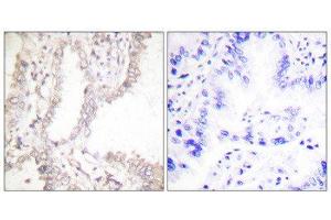 Immunohistochemistry (IHC) image for anti-PRKC, Apoptosis, WT1, Regulator (PAWR) (C-Term) antibody (ABIN1848751) (PAWR Antikörper  (C-Term))