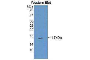 Western blot analysis of the recombinant protein. (TNP2 Antikörper  (AA 1-117))