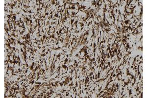 ABIN6273105 at 1/100 staining Human gastric tissue by IHC-P. (CREB3L1 Antikörper  (N-Term))