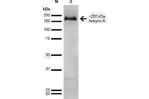 Western Blot analysis of Rat Brain showing detection of ~200 kDa Ankyrin-R protein using Mouse Anti-Ankyrin-R Monoclonal Antibody, Clone S388A-10 . (Erythrocyte Ankyrin Antikörper  (AA 1-1881) (Atto 488))
