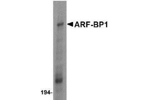 Western blot analysis of ARF-BP1 in Daudi cell lysate with ARF-BP1 antibody at 1 μg/ml. (HUWE1 Antikörper  (C-Term))