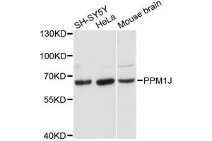 Western blot analysis of extracts of various cell lines, using PPM1J antibody. (PPM1J Antikörper)