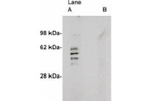 Image no. 1 for anti-Sphingomyelin Synthase 2 (SGMS2) antibody (ABIN4620351)