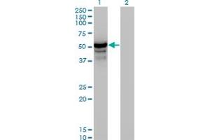 Western Blotting (WB) image for anti-Homocysteine-Inducible, Endoplasmic Reticulum Stress-Inducible, Ubiquitin-Like Domain Member 1 (HERPUD1) (AA 74-181) antibody (ABIN466153) (HERPUD1 Antikörper  (AA 74-181))