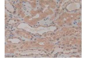 IHC-P analysis of Human Kidney Tissue, with DAB staining. (NUP210 Antikörper  (AA 1288-1449))