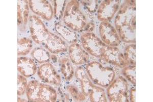 DAB staining on IHC-P; Samples: Human Kidney Tissue (IL12A Antikörper  (AA 23-219))