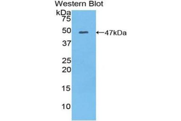 MYL6B anticorps  (AA 6-137)