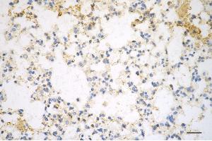 Immunohistochemistry was performed on paraffin-embedded mouse lung using pannexin 1 antibody (ABIN7799733), 1:200).
