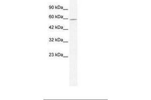 Image no. 1 for anti-DEAD (Asp-Glu-Ala-Asp) Box Polypeptide 47 (DDX47) (AA 41-90) antibody (ABIN203145) (DDX47 Antikörper  (AA 41-90))