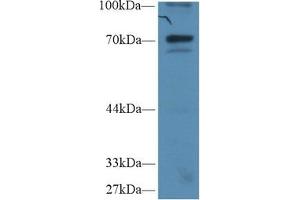 Detection of IkBz in Human Hela cell lysate using Polyclonal Antibody to Inhibitory Subunit Of NF Kappa B Zeta (IkBz) (Inhibitory Subunit of NF-KappaB zeta (AA 422-651) Antikörper)
