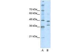 WB Suggested Anti-SMARCB1  Antibody Titration: 0. (SMARCB1 Antikörper  (Middle Region))