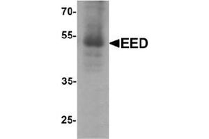 Western blot analysis of EED in human heart tissue lysate with EED Antibody  at 1 μg/ml. (EED Antikörper  (N-Term))